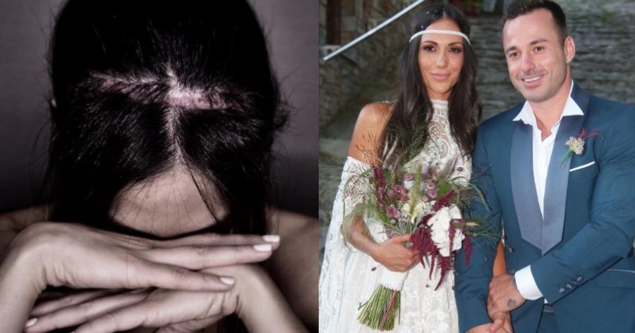 «Ο σύζυγός μου δεν λάκισε όταν διαγνώστηκα με όγκο στο κεφάλι, αν και ήμασταν λίγο καιρό μαζί» -Οι δηλώσεις της Ανθής Βούλγαρη