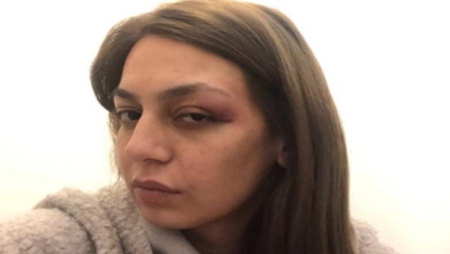 «Δέχθηκε αγκωνιά στο μάτι από δυνάμεις των ΜΑΤ» – Σοβαρή καταγγελία από τη βουλευτή του ΜέΡΑ25, Μαρία Απατζίδη