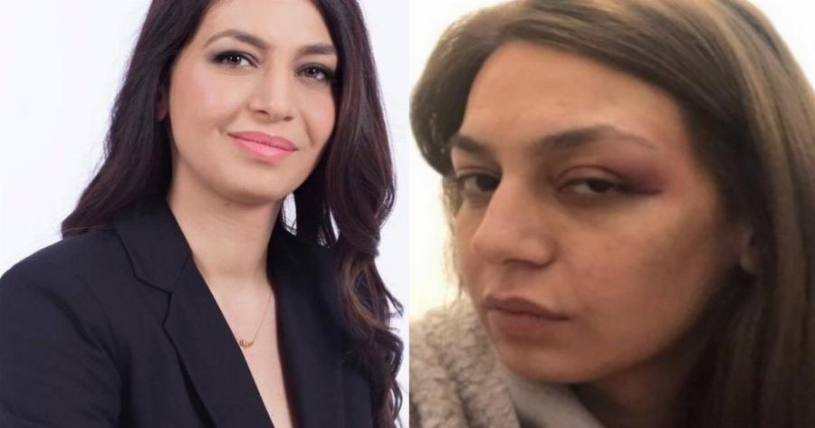 «Δέχθηκε αγκωνιά στο μάτι από δυνάμεις των ΜΑΤ» – Σοβαρή καταγγελία από τη βουλευτή του ΜέΡΑ25, Μαρία Απατζίδη