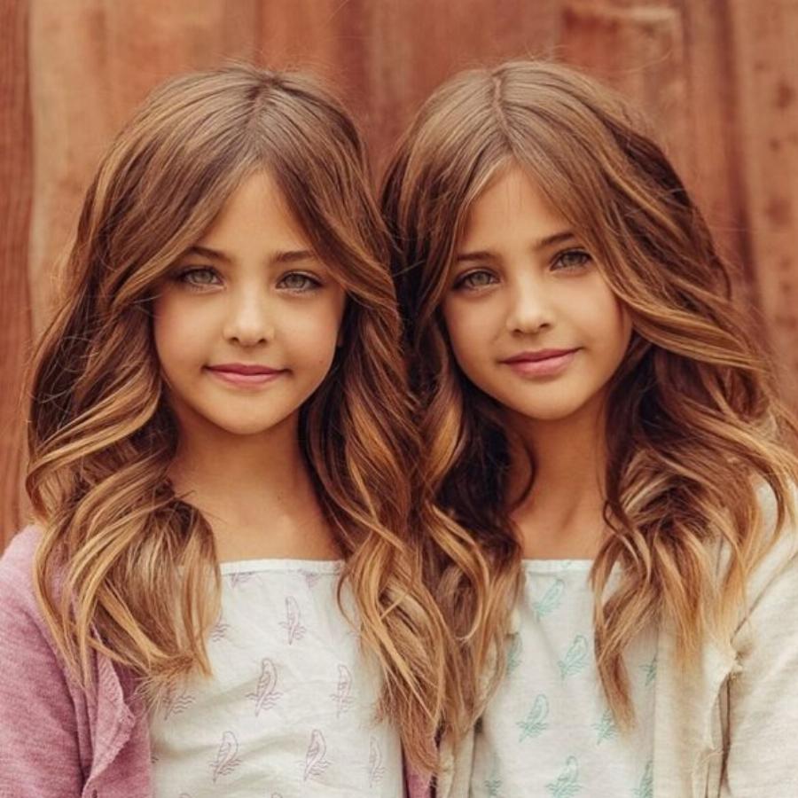 Οι πιο όμορφες δίδυμες στον κόσμο έγιναν 9 ετών και μοιάζουν σαν άγγελοι