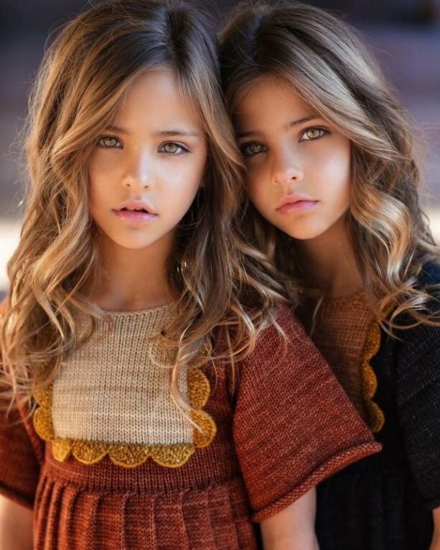 Οι πιο όμορφες δίδυμες στον κόσμο έγιναν 9 ετών και μοιάζουν σαν άγγελοι