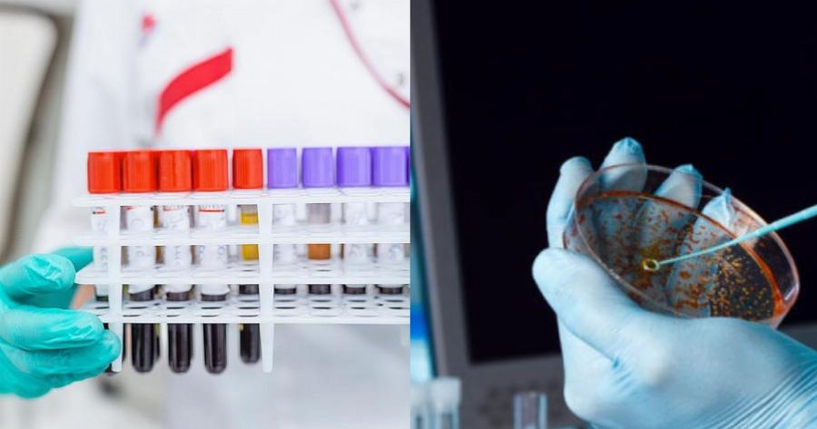 Ξεκινά στην Βρετανία η μεγαλύτερη παγκόσμια δοκιμή για εντοπισμό του καρκίνου πριν την εμφάνιση συμπτωμάτων