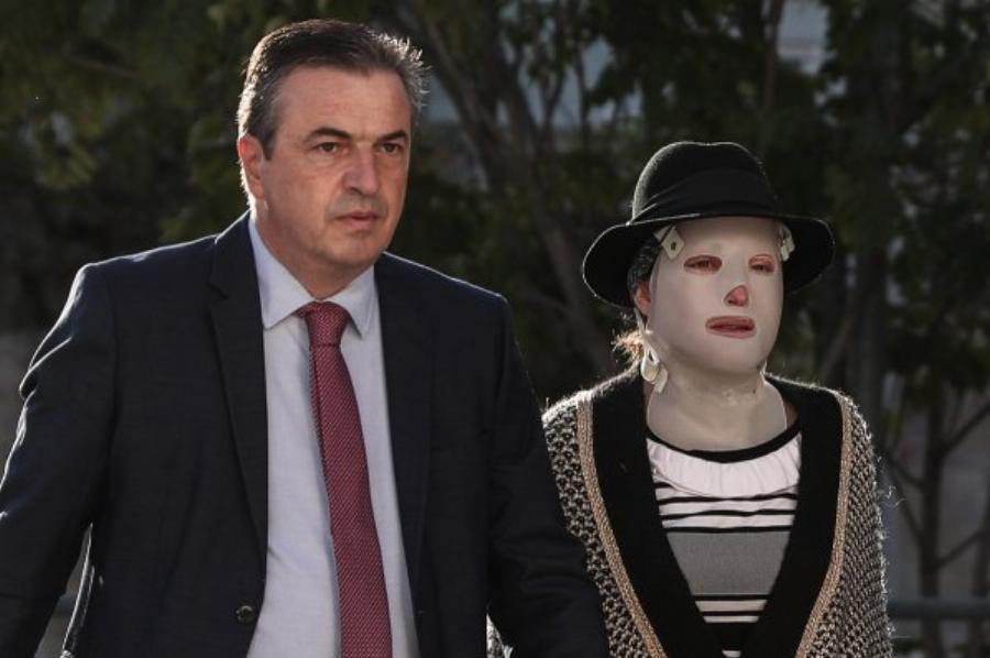 “Δεν έχω ξανασυναντήσει «έναν άνθρωπο χωρίς πρόσωπο” – Oι δηλώσεις του Ψυχολόγου της Ιωάννας