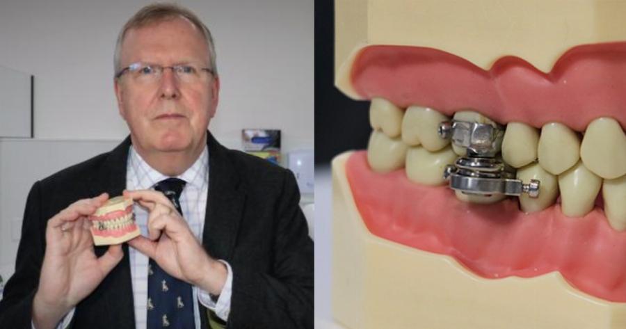 Νέα συσκευή για απώλεια βάρους εμποδίζει το στόμα να ανοίγει πάνω από 2 χιλιοστά