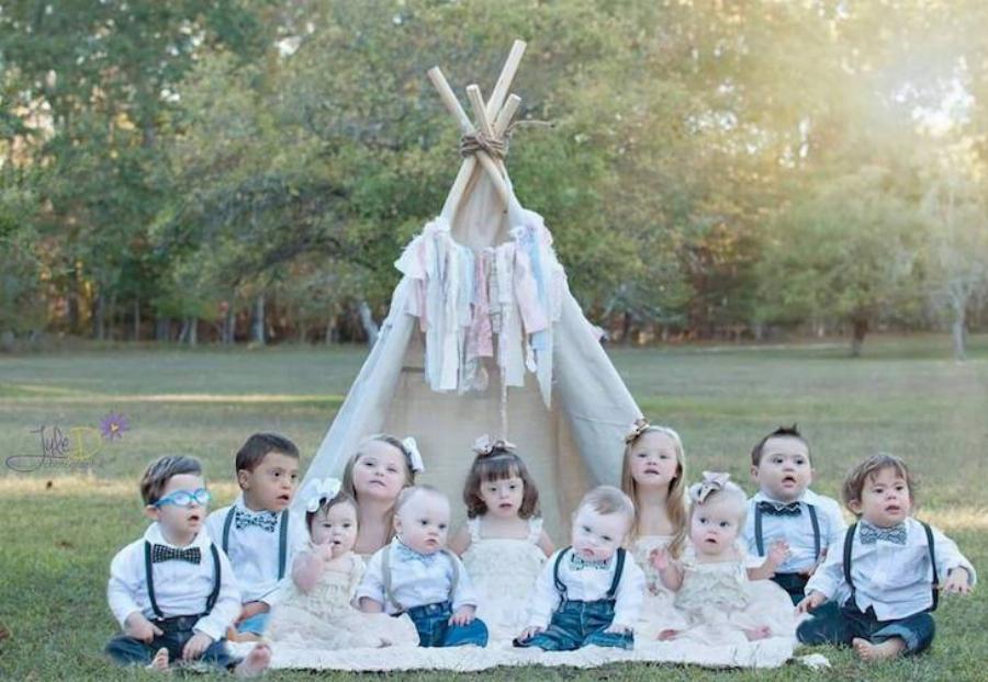 Συγκινητικές εικόνες: Γυναίκα φωτογραφίζει παιδιά με σύνδρομο Down για να αναδείξει την γλυκύτητα και την διαφορετικότητα τους