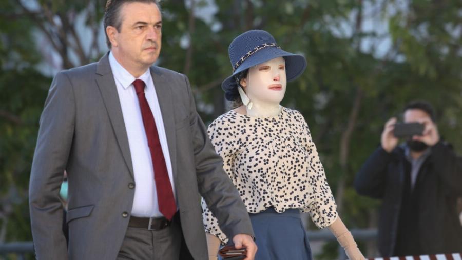 «Η θερμοκρασία στα εγκαύματά της ξεπερνούσε τους 400 βαθμούς – Τήν έσωσε το νερό που έριξε η φαρμακοποιός»