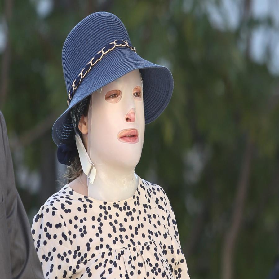 “Δεν έχω ξανασυναντήσει «έναν άνθρωπο χωρίς πρόσωπο” – Oι δηλώσεις του Ψυχολόγου της Ιωάννας