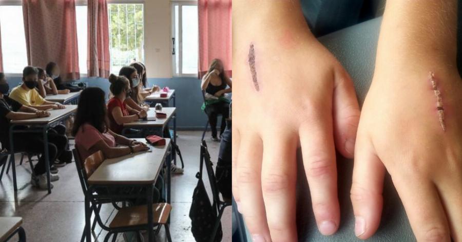 Νέα ανόητη «πρόκληση» που έχει ξεκινήσει στα σχολεία: Γυρνούν σπίτι με πληγωμένα χέρια