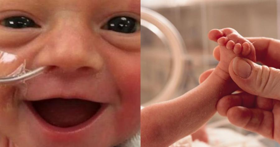 Το πιο όμορφο χαμόγελο από ένα πρόωρο μωρό – «Είναι χαρούμενη που ζει!»