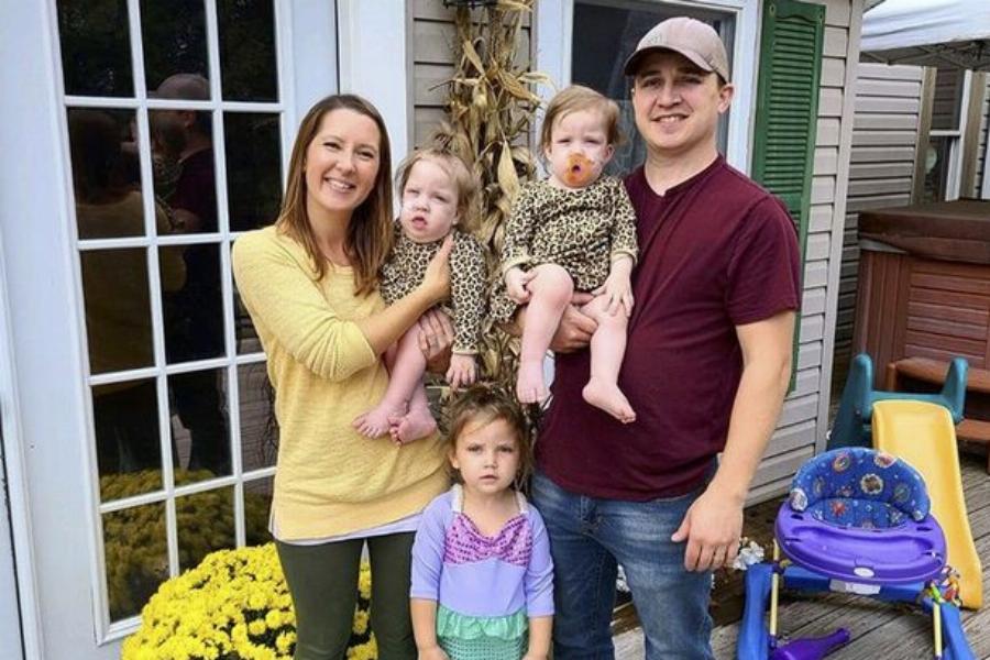 Σιαμαία κοριτσάκια: Γεννήθηκαν με ενωμένη κοιλιά και στήθος, επέζησαν από θαύμα