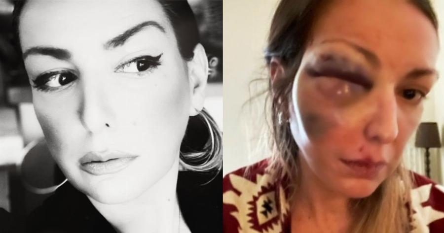 Το χυδαίο μήνυμα που έλαβε η food blogger Στεφανία Τζαφέρη μετά τον άγριο ξυλοδαρμό της