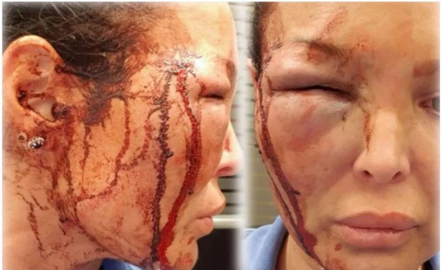 Στα δικαστήρια ο Μανώλης Παπαμακάριος για τον ξυλοδαρμό της συζύγου του