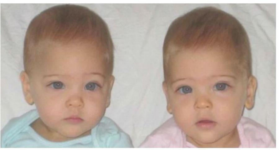 Οι πιο όμορφες δίδυμες στον κόσμο έγιναν 9 ετών και μοιάζουν σαν άγγελοι