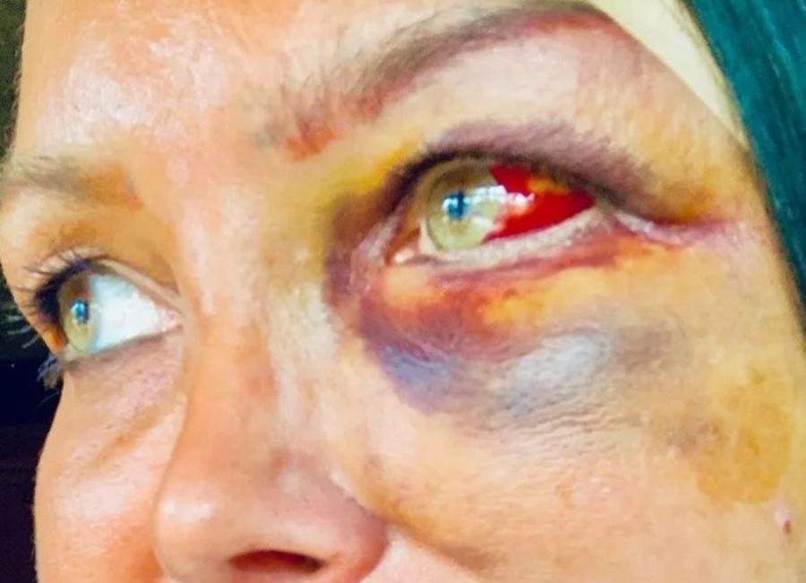 Στα δικαστήρια ο Μανώλης Παπαμακάριος για τον ξυλοδαρμό της συζύγου του