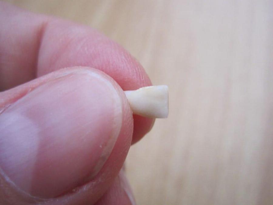 Γιατί επιβάλλεται να κρατάμε τα πρώτα δόντια των παιδιών μας