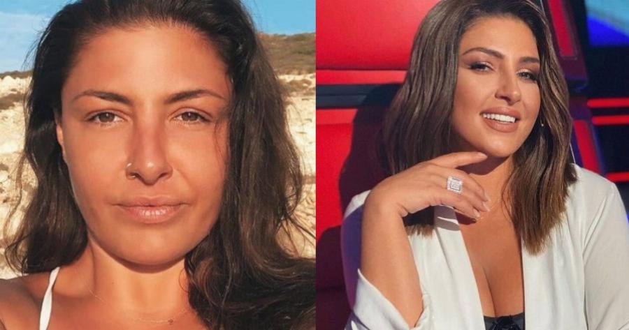 Έλενα Παπαρίζου: Με baby μπότοξ εμφανίστηκε στις πρόβες του MadWalk – Η νέα της εικόνα