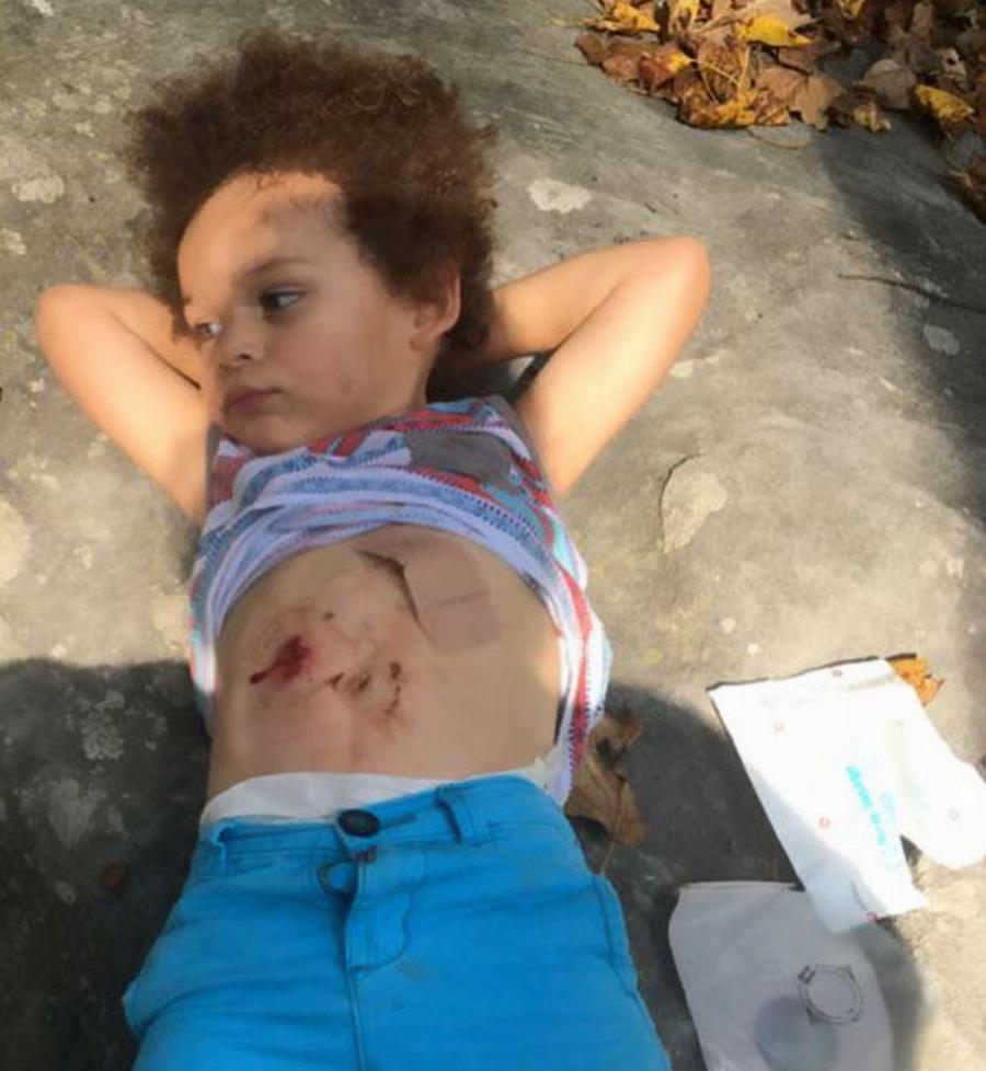 Μια μητέρα δίνει την καλύτερη απάντηση στην γυναίκα που προσέβαλε τον γιο της για το πρόβλημα υγείας του