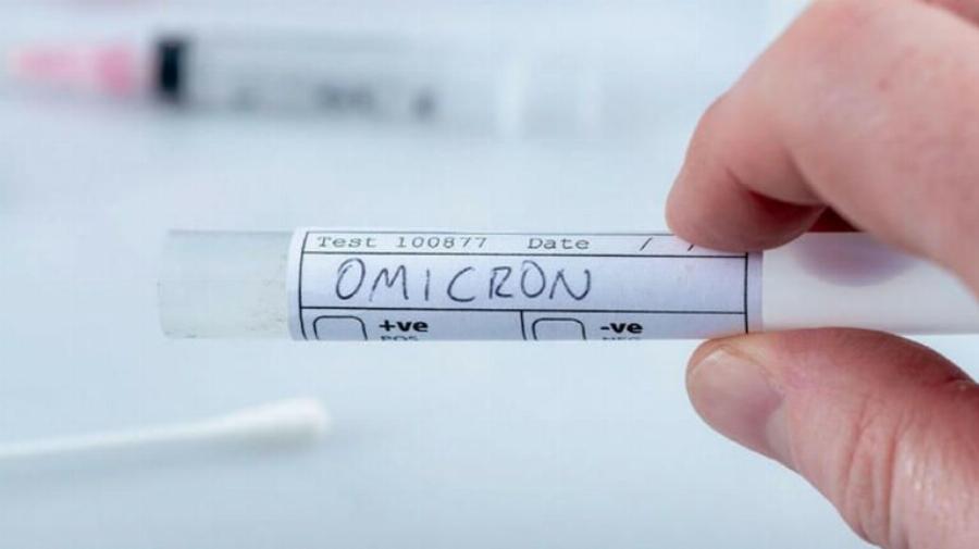 Μετάλλαξη Όμικρον: Μεταδοτικότητα – Την πιάνουν εμβόλια και rapid test; 11 απαντήσεις Μόσιαλου για μετάλλαξη Μποτσουάνας