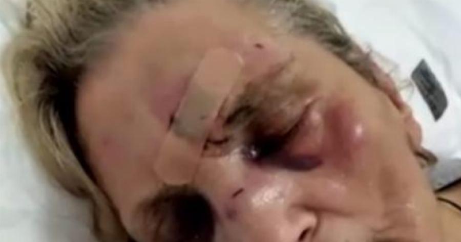 «Αποκλειστική νοσοκόμα» σακάτεψε στο ξύλο την ηλικιωμένη που «φρόντιζε» στο Τζάνειο Νοσοκομείο!