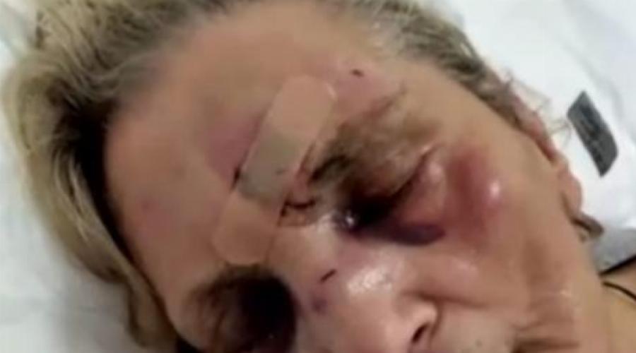 «Αποκλειστική νοσοκόμα» σακάτεψε στο ξύλο την ηλικιωμένη που «φρόντιζε» στο Τζάνειο Νοσοκομείο!