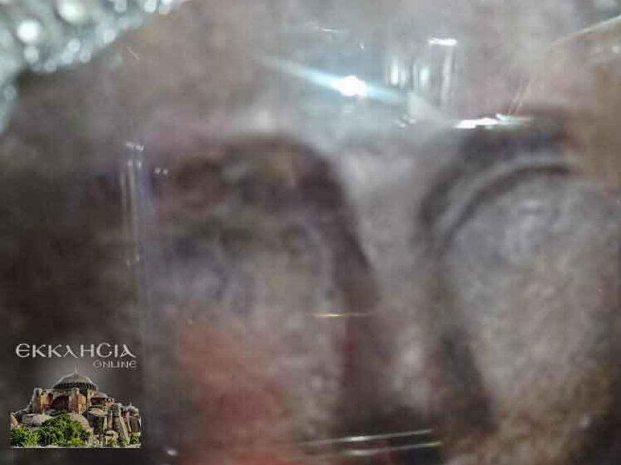 Καθαρές οι εξετάσεις παιδιού από τη Λέρο- Δακρύζει συνέχεια ο Ταξιάρχης στην Κερατέα