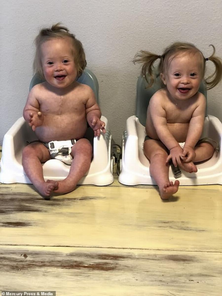 Μια μαμά που έφερε στον κόσμο δίδυμα με σύνδρομο Down ανοίγει την καρδιά της και συγκινεί