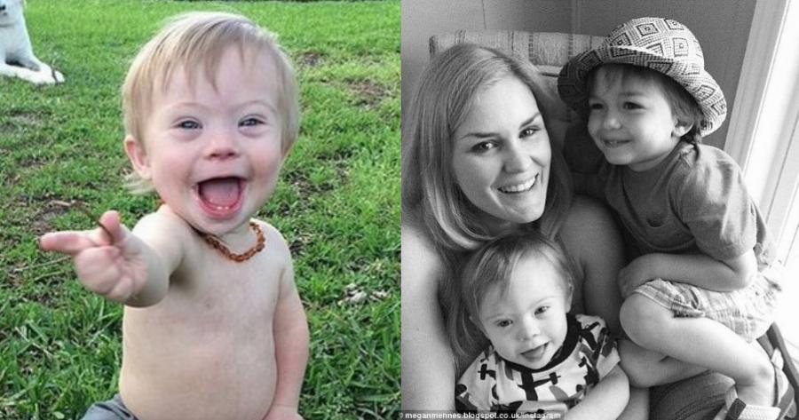 Η αποστομωτική απάντηση της μητέρας όταν αποκάλεσαν “άσχημο” το παιδί της με Σύνδρομο Down