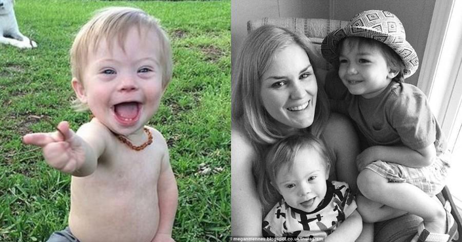 Η αποστομωτική απάντηση της μητέρας όταν αποκάλεσαν “άσχημο” το παιδί της με Σύνδρομο Down