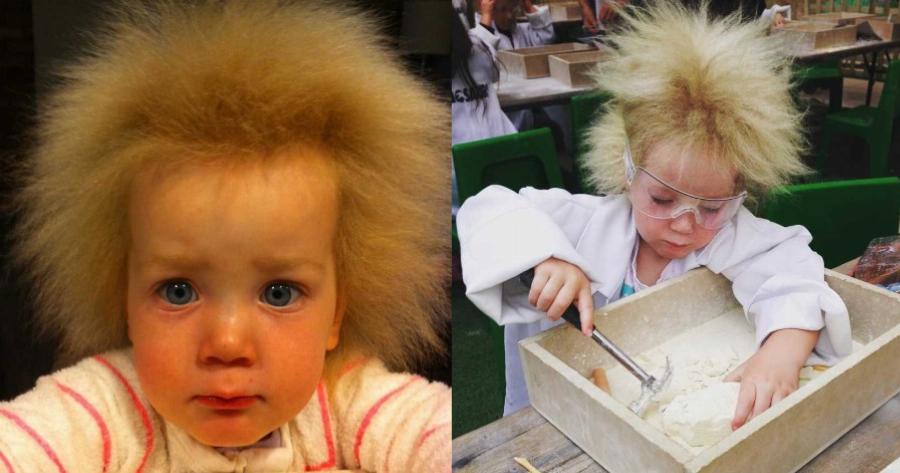 «Σαν να έβαλε το χέρι της στην πρίζα: Όλοι γελάνε με την κόρη μου, αλλά πάσχει από πολύ σπάνιο σύνδρομο»