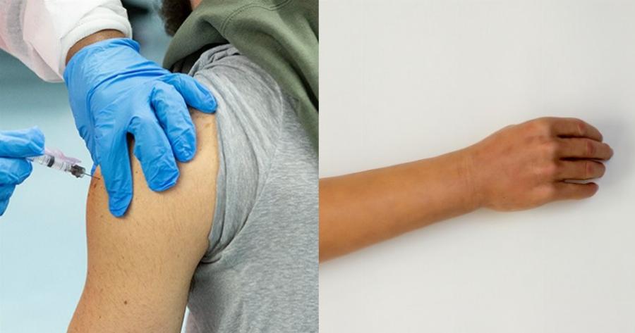 Απίστευτο περιστατικό στην Ιταλία: Με ψεύτικο χέρι σιλικόνης παρουσιάστηκε 50χρονος για να εμβολιαστεί