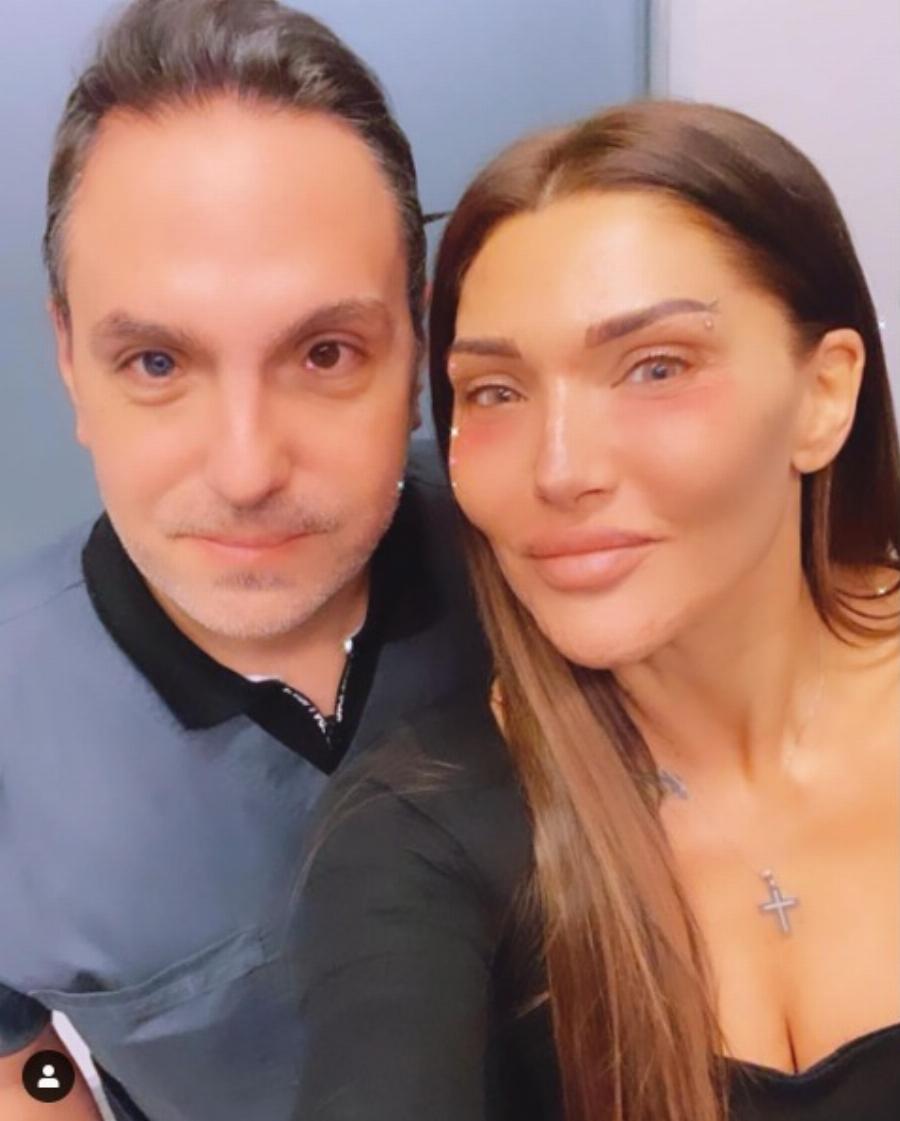 Αγγελική Ηλιάδη: Η αποστομωτική απάντηση σε προσβλητικό σχόλιο για παραμόρφωση στο πρόσωπό της