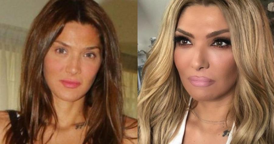 Αγγελική Ηλιάδη: Η αποστομωτική απάντηση σε προσβλητικό σχόλιο για παραμόρφωση στο πρόσωπό της