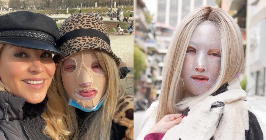 Ιωάννα Παλιοσπύρου: Το ταξίδι στο Παρίσι για τις θεραπείες αποκατάστασης και οι μαγικές φωτογραφίες της και βίντεο