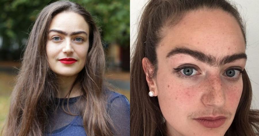 Κοπεγχάγη: 31χρονη γυναίκα πέταξε το τσιμπιδάκι και το ξυραφάκι της – Θέλει να νιώθει θηλυκή ακόμη και με τις τρίχες της