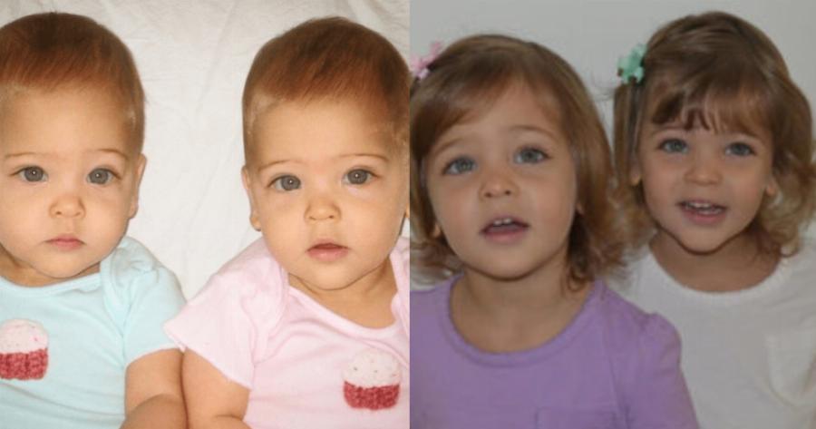 Απερίγραπτη η ομορφιά τους: Αυτά είναι τα πιο όμορφα δίδυμα κορίτσια σε ολόκληρο τον κόσμο