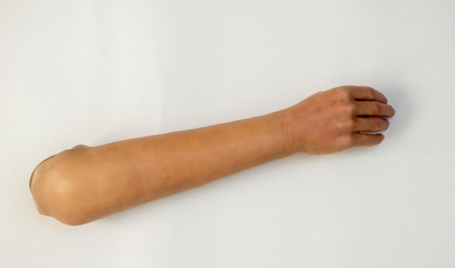 Απίστευτο περιστατικό στην Ιταλία: Με ψεύτικο χέρι σιλικόνης παρουσιάστηκε 50χρονος για να εμβολιαστεί