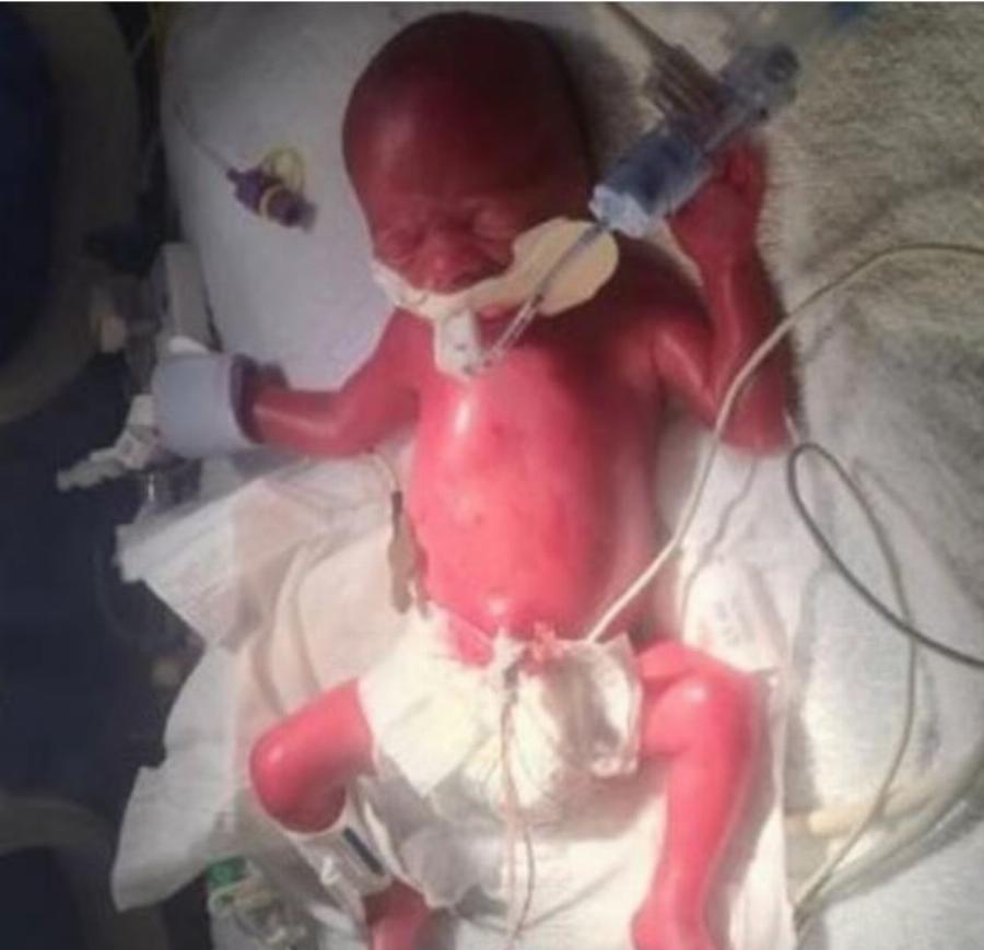 Mετά από σκληρή μάχη 125 ημερών πρόωρο μωρό θα κάνει Χριστούγεννα σπίτι του