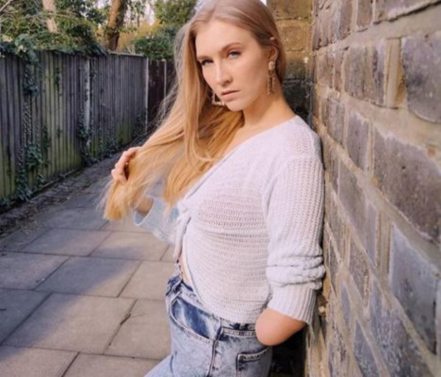 Αυτά τα 12 μοντέλα κατέρριψαν τα πρότυπα ομορφιάς και απέδειξαν ότι ο κάθε άνθρωπος είναι όμορφος