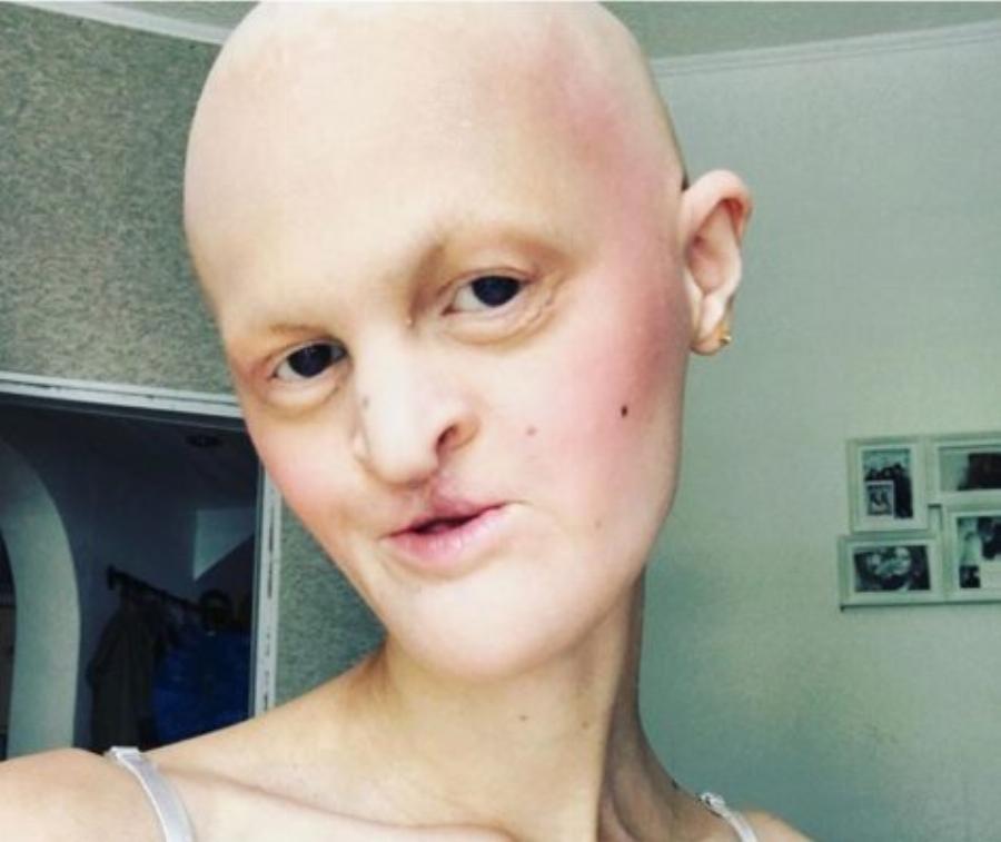 Αυτά τα 12 μοντέλα κατέρριψαν τα πρότυπα ομορφιάς και απέδειξαν ότι ο κάθε άνθρωπος είναι όμορφος