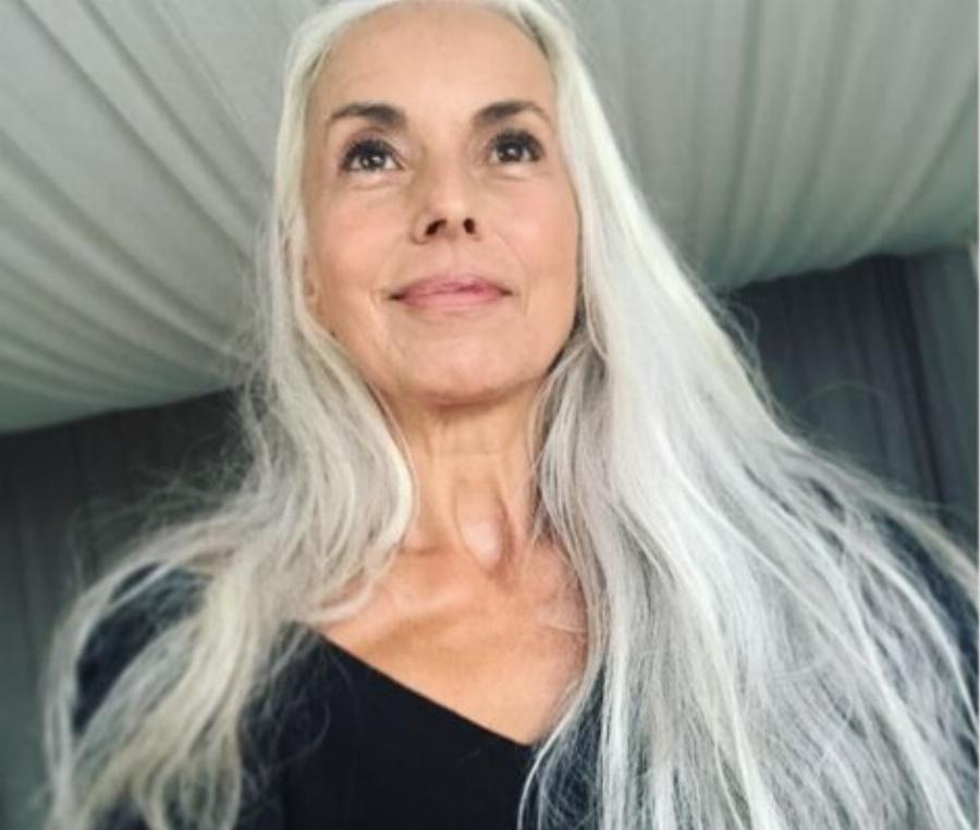 Αυτά τα 12 μοντέλα κατέρριψαν τα πρότυπα ομορφιάς και απέδειξαν ότι ο κάθε άνθρωπος είναι όμορφος