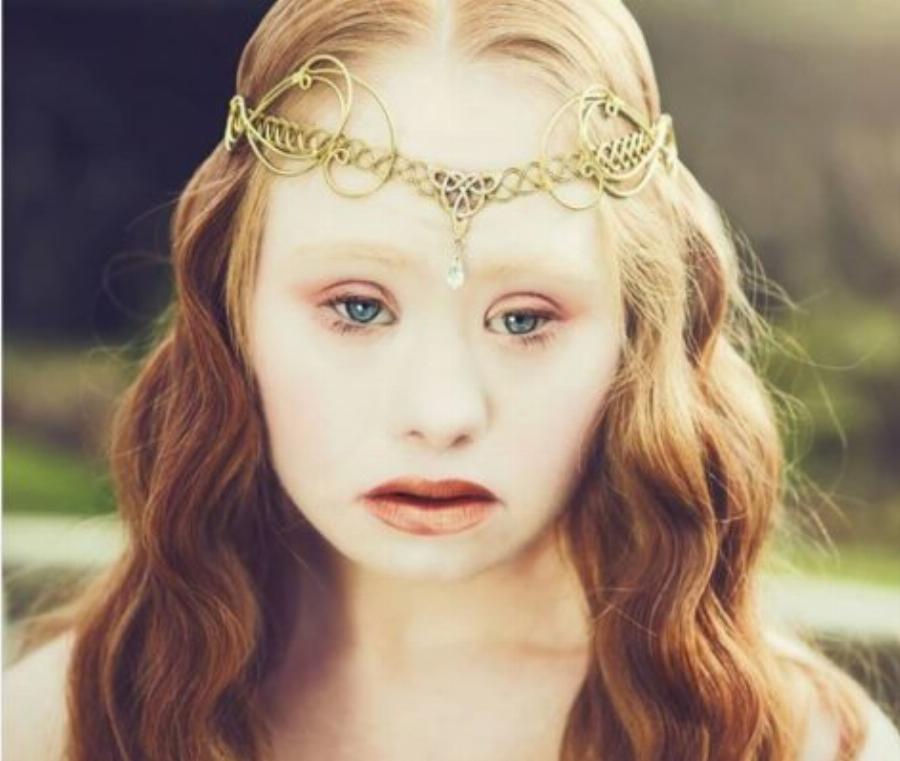 Αυτά τα 12 μοντέλα κατέρριψαν τα πρότυπα ομορφιάς και απέδειξαν ότι ο κάθε άνθρωπος είναι όμορφος