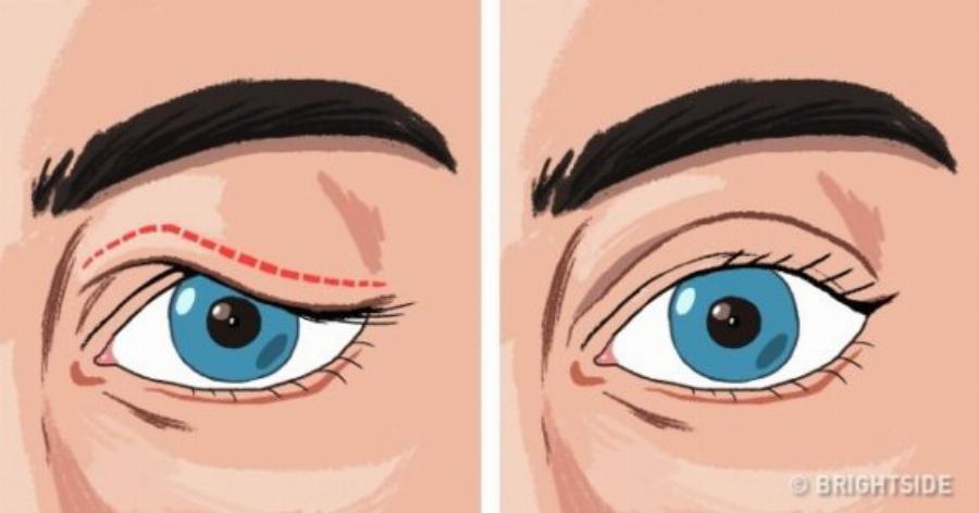 Mυστικά ομορφιάς: Οι 7 μέθοδοι για να απαλλαγείτε από τα πεσμένα βλέφαρα και να αποκτήσετε νεανικό βλέμμα