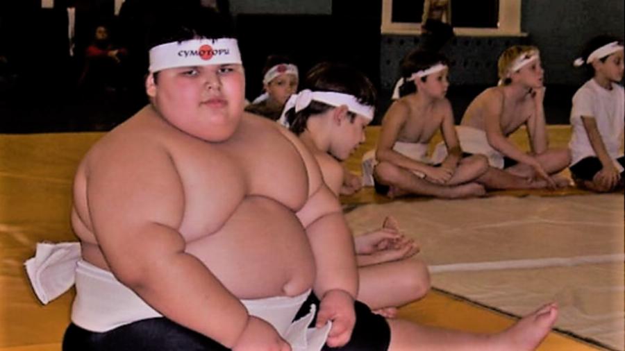 Το «Παχύτερο παιδί στον κόσμο»: Ο μικρός που στα 6 του ζύγιζε 100 κιλά και πέθανε στα 21 από νεφρική ανεπάρκεια