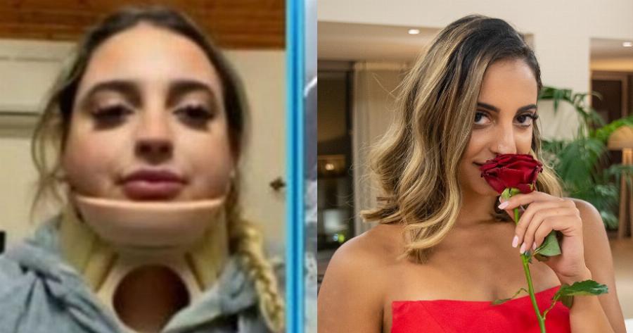 «Με έσωσε ο Άγιος Ιωάννης»: Σοβαρό τροχαίο για την Ραφαέλα του «Bachelor» – Άμορφη μάζα το αυτοκίνητο