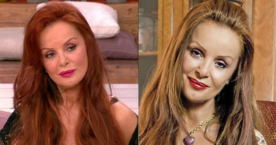 Χρυσηίδα Δημουλίδου: Διαγνώστικα με αυτοάνοσο μετά τη 2η δόση και μου έπεσαν τα μαλλιά – Αρρώστησα και με βρίζουν