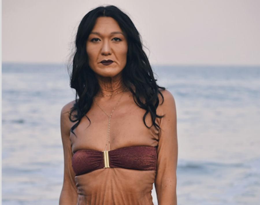 Αυτά τα 12 μοντέλα κατέρριψαν τα πρότυπα ομορφιάς και απέδειξαν ότι ο κάθε άνθρωπος είναι όμορφος