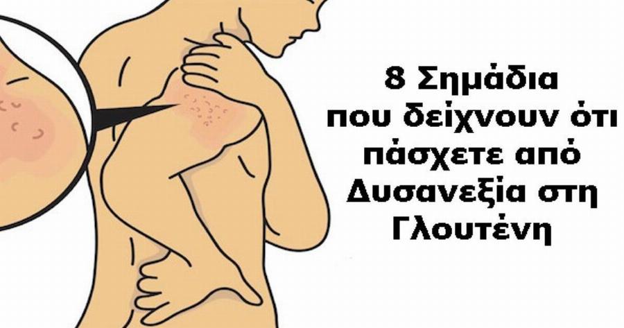 Δυσανεξία στη γλουτένη: 8 Σημάδια «καμπανάκια» που μας προειδοποιούν