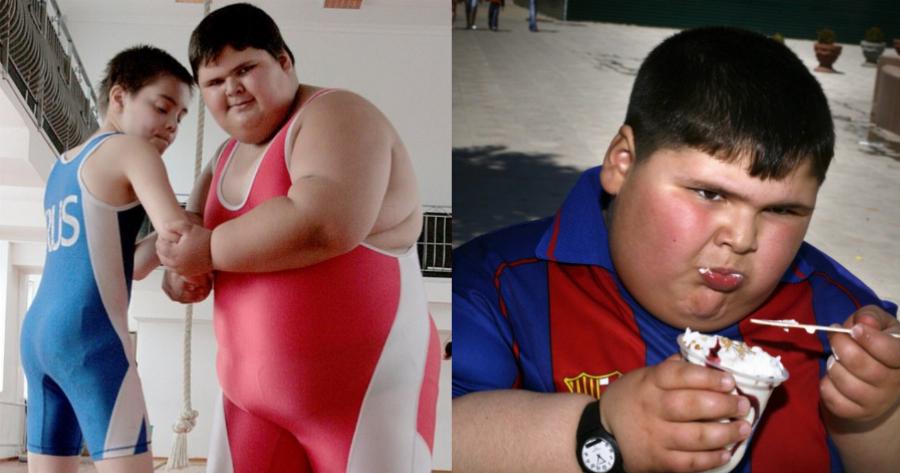 Το «Παχύτερο παιδί στον κόσμο»: Ο μικρός που στα 6 του ζύγιζε 100 κιλά και πέθανε στα 21 από νεφρική ανεπάρκεια