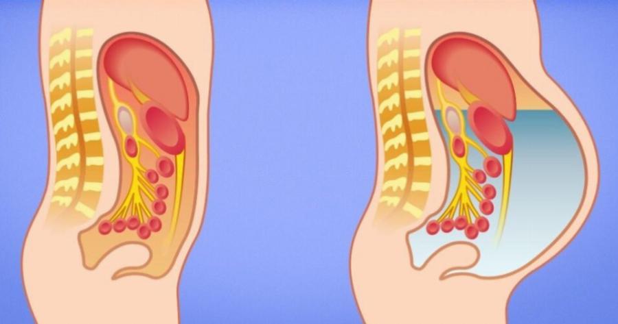 Αποτοξίνωση συκωτιού: Ποιες είναι οι 8 τροφές που αποτοξινώνουν και συμβάλλουν στην γρήγορη απώλεια βάρους