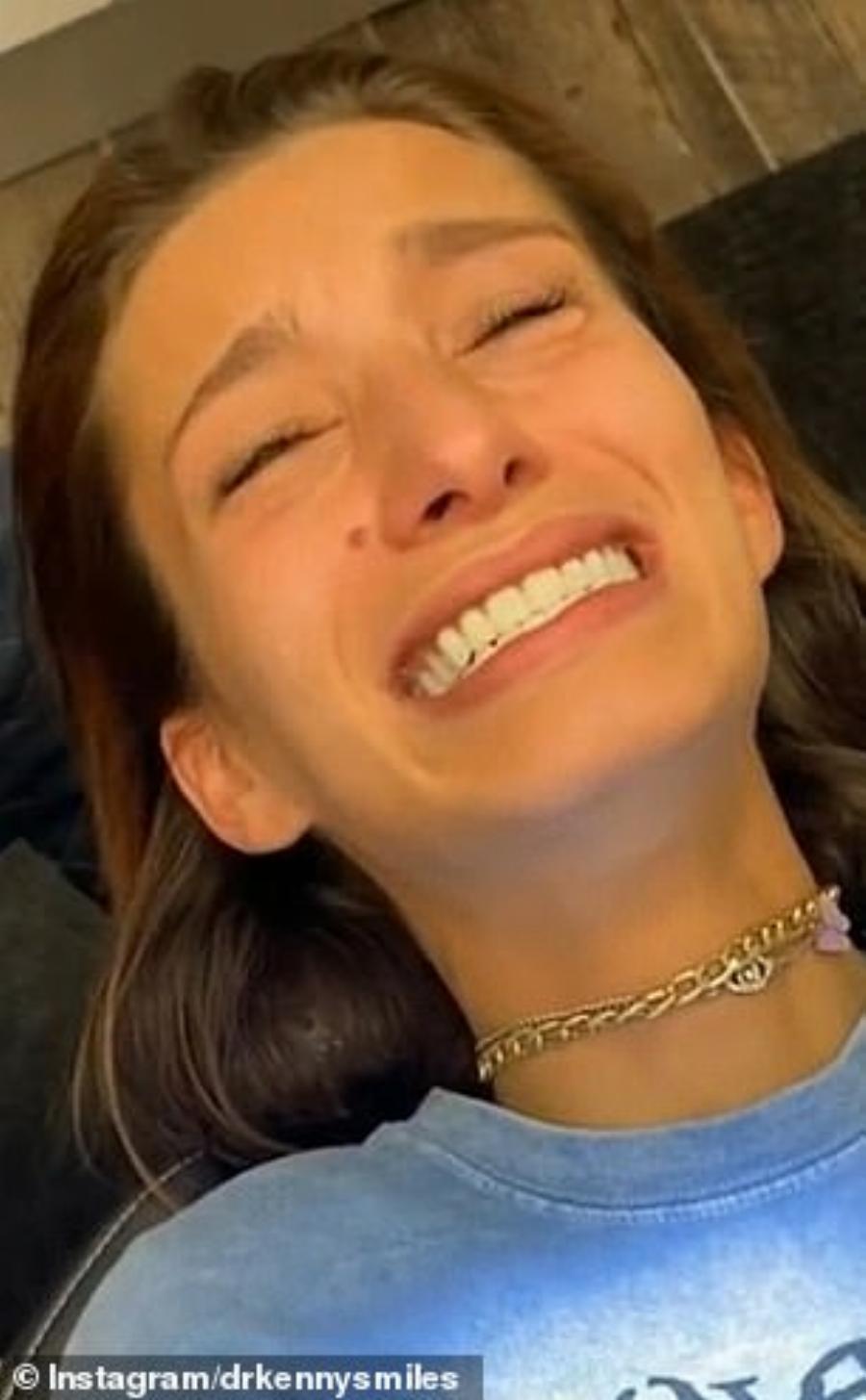 Γυναίκα έχασε όλα τα δόντια της από τις καταχρήσεις και ο οδοντίατρος την μεταμόρφωσε σε ένα πανέμορφο πλάσμα